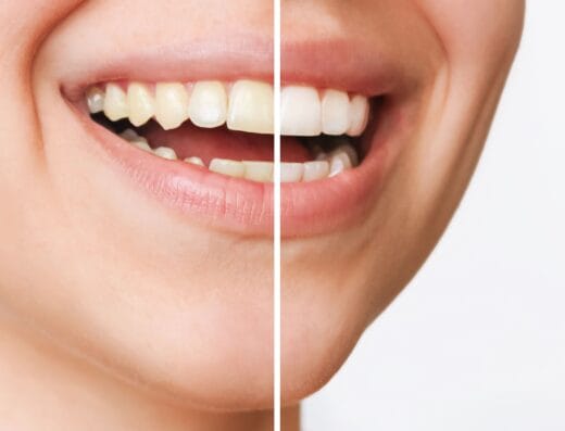 Clínica Dental Vitaldent Tres Cantos